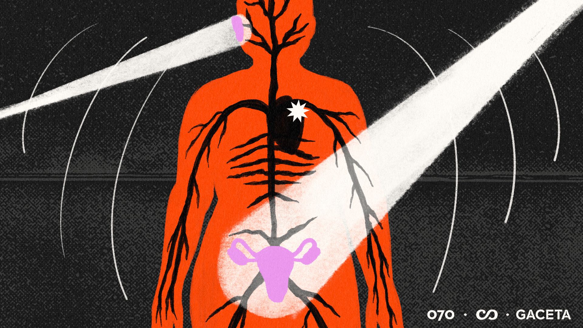 Nancy contra el ruido