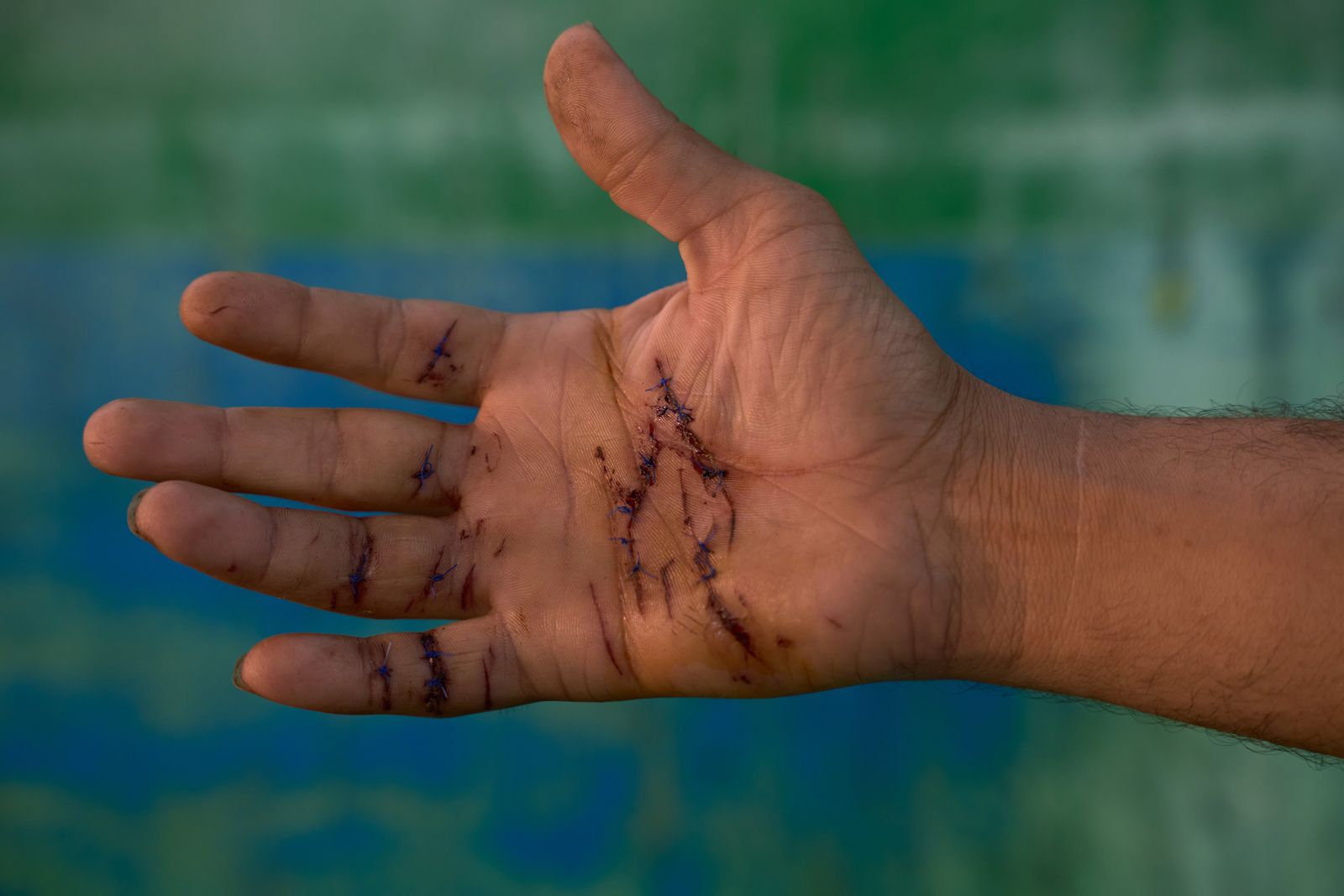 Esta serie fotográfica hace parte de MÁS VIDA, un proyecto documental sobre reducción de daños en Colombia de VIST PROJECTS.